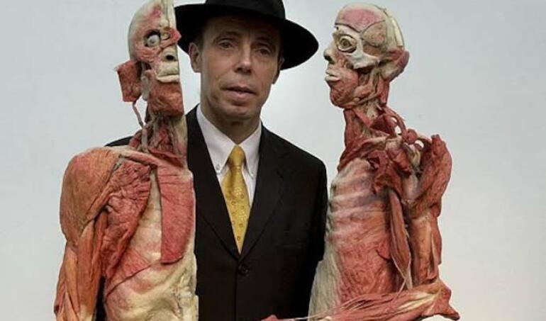 Muere anatomista Gunther von Hagens, creador de las polémicas exposiciones de cadáveres humanos "Body Worlds"